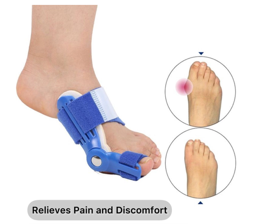 Orthopedic Toe Alignment Bunion Corrector - Pack of 2