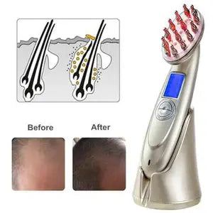 Laser Hair Regrowth Comb